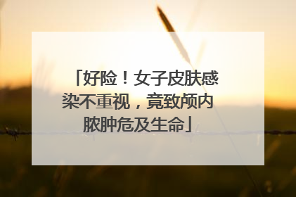 好险！女子皮肤感染不重视，竟致颅内脓肿危及生命